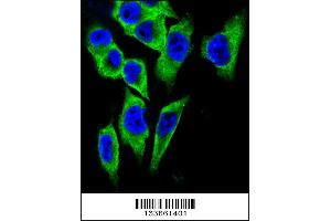 Confocal immunofluorescent analysis of LDHA Antibody with A375 cell followed by Alexa Fluor 488-conjugated goat anti-rabbit lgG (green). (Lactate Dehydrogenase A antibody  (C-Term))