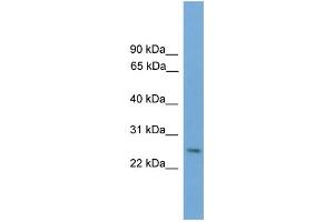WB Suggested Anti-Dlx4 Antibody Titration: 0. (DLX4 antibody  (Middle Region))