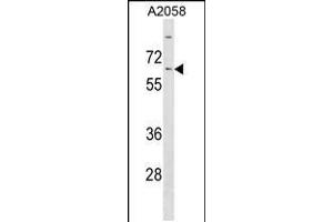 Western blot analysis in A2058 cell line lysates (35ug/lane). (KLHL14 antibody  (AA 392-418))