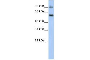 WB Suggested Anti-ASCC2 Antibody Titration:  0. (ASCC2 antibody  (Middle Region))