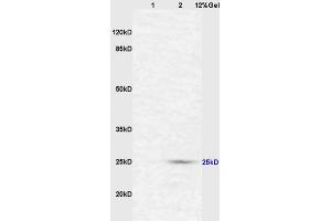 Lane 1: mouse intestine lysates Lane 2: mouse liver lysates probed with Anti CD161c/NK1. (NK-1.1/CD161c antibody  (AA 101-200))