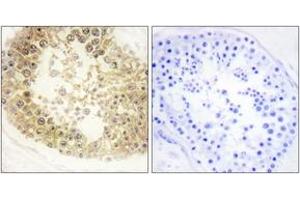 Immunohistochemistry analysis of paraffin-embedded human testis tissue, using ECRG4 Antibody.