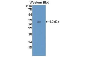 Western blot analysis of the recombinant protein. (Fibrosin antibody  (AA 1-250))