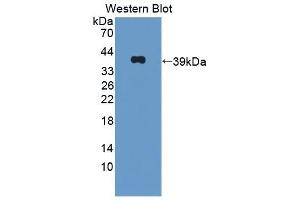 Detection of Recombinant OXTR, Mouse using Polyclonal Antibody to Oxytocin Receptor (OXTR) (Oxytocin Receptor antibody  (AA 6-75))