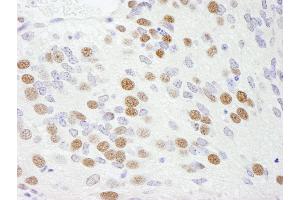 Immunohistochemistry (IHC) image for anti-RNA Binding Motif Protein 9 (RBM9) (AA 1-50) antibody (ABIN7448568) (RBM9 antibody  (AA 1-50))