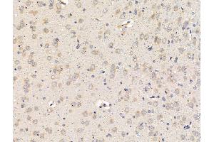 ABIN7094615 and ABIN7098665 at 1/100 staining Rat brain tissue by IHC-P.