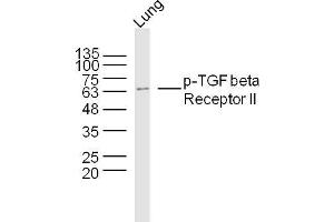 Mouse lung lysates probed with TGF beta Receptor II (Ser225) Polyclonal Antibody, Unconjugated  at 1:300 dilution and 4˚C overnight incubation. (TGFBR2 antibody  (pSer225))