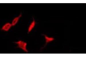 ABIN6278702 staining HepG2 by IF/ICC. (Varicella Zoster Virus Thymidine kinase (VZV TK) antibody)