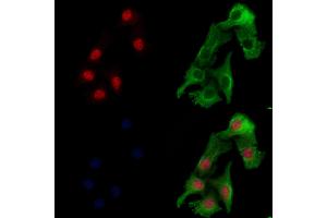 ABIN6257571 and ABIN6274504 staining Hela cells by IF/ICC.