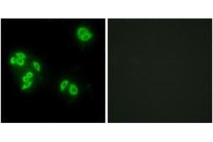 Immunofluorescence analysis of A549 cells, using TFIP8 Antibody. (Cytokeratin 5 antibody  (AA 31-80))