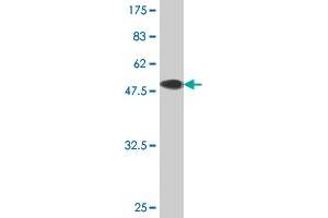 Western Blot detection against Immunogen (51. (TK1 antibody  (AA 1-234))