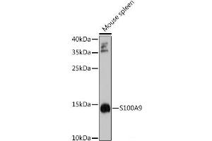 Western blot analysis of extracts of Mouse spleen using S100A9 Polyclonal Antibody at dilution of 1:1000. (S100A9 antibody)