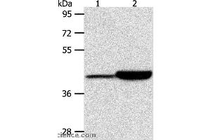 Western blot analysis of Jurkat and RAW264. (CAPG antibody)