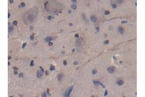 Used in DAB staining on fromalin fixed paraffin- embedded kidney tissue (CD8B antibody  (AA 21-208))