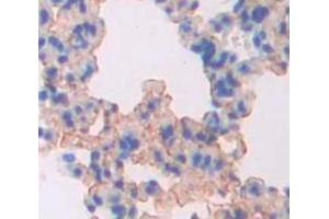 Figure. (PPOX antibody  (AA 12-471))