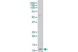 FXYD3 polyclonal antibody (A01), Lot # ISI4060209QCS1 Western Blot analysis of FXYD3 expression in A-431 (FXYD3 antibody  (AA 21-87))