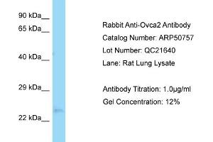 WB Suggested Anti-Ovca2 Antibody   Titration: 1.