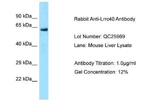 Host: Rabbit Target Name: Lrrc40 Sample Type: Mouse Liver Antibody Dilution: 1. (LRRC40 antibody  (C-Term))