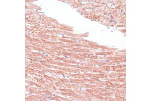 Immunohistochemistry of paraffin-embedded mouse heart using FZD4 antibody (ABIN6131550, ABIN6140841, ABIN6140842 and ABIN6224186) at dilution of 1:100 (40x lens). (FZD4 antibody  (AA 37-222))