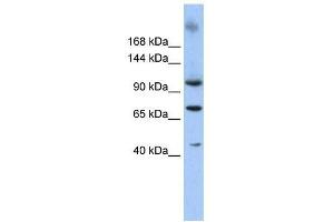 Western Blot showing TUT1 antibody used at a concentration of 1-2 ug/ml to detect its target protein.