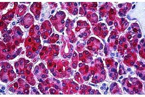 Human Pancreas: Formalin-Fixed, Paraffin-Embedded (FFPE) (PHGDH antibody  (AA 1-534))