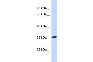 Host:  Rabbit  Target Name:  NAALAD2  Sample Type:  Fetal Brain lysates  Antibody Dilution:  1. (NAALAD2 antibody  (Middle Region))