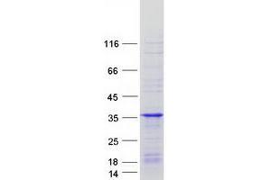 Western Blotting (WB) image for Ras-Like Without CAAX 1 (RIT1) protein (Myc-DYKDDDDK Tag) (ABIN2730963)