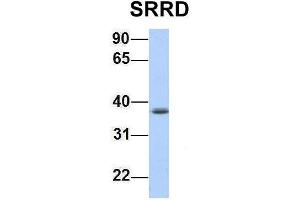 Host:  Rabbit  Target Name:  SRRD  Sample Type:  Jurkat  Antibody Dilution:  1. (SRRD antibody  (Middle Region))