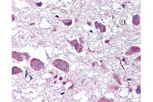 Anti-HCRT / Orexin antibody IHC of human brain, hypothalamus. (Orexin antibody  (AA 2-14))