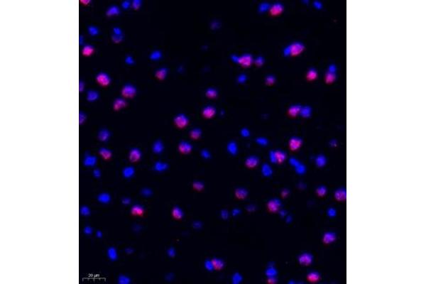 PHF10 antibody