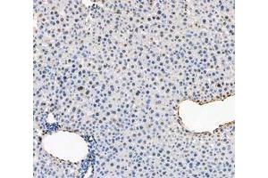 IHC analysis of ADK using anti-ADK antibody (ABIN4886430). (ADK antibody  (AA 165-351))