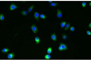 Immunofluorescent analysis of A2780 cells using ABIN7174666 at dilution of 1:100 and Alexa Fluor 488-congugated AffiniPure Goat Anti-Rabbit IgG(H+L)