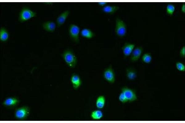 SLC35B4 Antikörper  (AA 174-200)