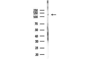 anti-Bromodomain and PHD Finger Containing, 3 (BRPF3) antibody