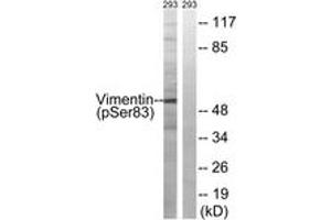 Western blot analysis of extracts from 293 cells treated with paclitaxel 1uM 24h, using Vimentin (Phospho-Ser83) Antibody. (Vimentin antibody  (pSer83))