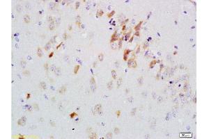 Formalin-fixed and paraffin embedded rat brain labeled with Anti-GDNF-Receptor-alpha-2 Polyclonal Antibody, Unconjugated 1:200 followed by conjugation to the secondary antibody and DAB staining (GFRA2 antibody  (AA 301-360))
