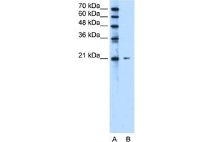 Western Blotting (WB) image for anti-Chromosome 20 Open Reading Frame 24 (C20ORF24) antibody (ABIN2463276) (C20ORF24 antibody)