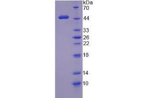 SDS-PAGE analysis of Human WT1 Protein.