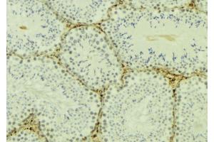 ABIN6277174 at 1/100 staining Mouse testis tissue by IHC-P. (TBP antibody  (N-Term))