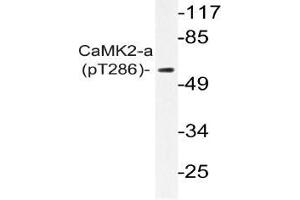 Western blot (WB) analysis of p-CaMK2-a antibody in extracts from A431 EGF cells (CAMK2A antibody  (pThr286))