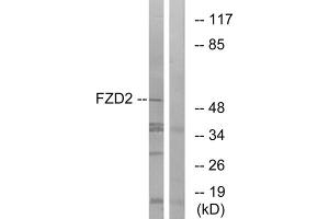 Western blot analysis of extracts from HeLa cells, using FZD2 antibody. (FZD2 antibody  (Internal Region))