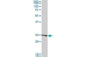 RAB33B monoclonal antibody (M01), clone 6F4. (RAB33B antibody  (AA 117-206))