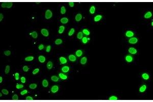 Immunofluorescence analysis of HeLa cells using SEPT7 Polyclonal Antibody (Septin 7 antibody)