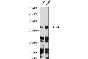 NPHP4 antibody  (AA 1247-1426)