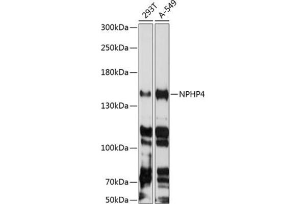 NPHP4 antibody  (AA 1247-1426)