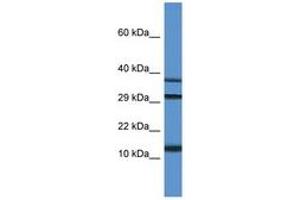 Image no. 1 for anti-Ubiquitin-Like 3 (UBL3) (C-Term) antibody (ABIN6746466) (UBL3 antibody  (C-Term))