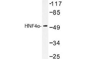 Image no. 1 for anti-Hepatocyte Nuclear Factor 4, alpha (HNF4A) antibody (ABIN317780) (HNF4A antibody)