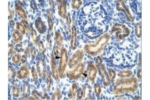 Image no. 1 for anti-Hematopoietic Cell-Specific Lyn Substrate 1 (HCLS1) (AA 28-77) antibody (ABIN202645) (HCLS1 antibody  (AA 28-77))