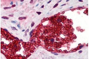 Human Placenta, Erythrocytes (formalin-fixed, paraffin-embedded) stained with SLC4A1 antibody ABIN290275 at 10 ug/ml followed by biotinylated goat anti-rabbit IgG secondary antibody ABIN481713, alkaline phosphatase-streptavidin and chromogen. (Band 3/AE1 antibody  (N-Term))