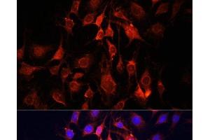 Immunofluorescence analysis of C6 cells using UCP3 Polyclonal Antibody at dilution of 1:100. (UCP3 antibody)